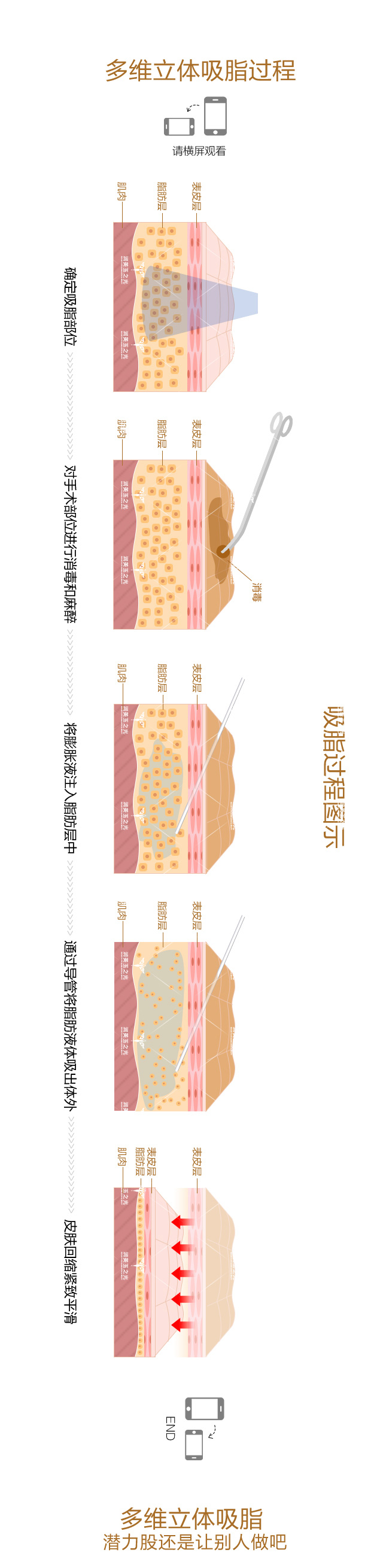 北京润美玉之光吸脂怎么样？价格案例分享